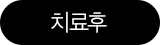치료후
