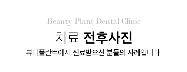 치료전후
